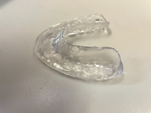 A typical occlusal splint to be worn by the patient at night as a conservative treatment option for temporomandibular disorders.
 